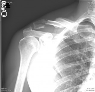 FitView – Broken Fitness FitView – Broken Fitness